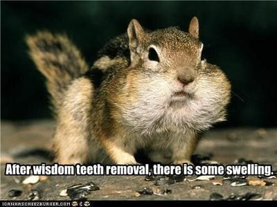 after-wisdom-teeth-meme.jpg